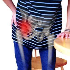 Objawy ból wysiłkowy, później spoczynkowy, pojawiający się w pachwinie i promieniujący na przednio-przyśrodkową część uda i do kolana (często objaw