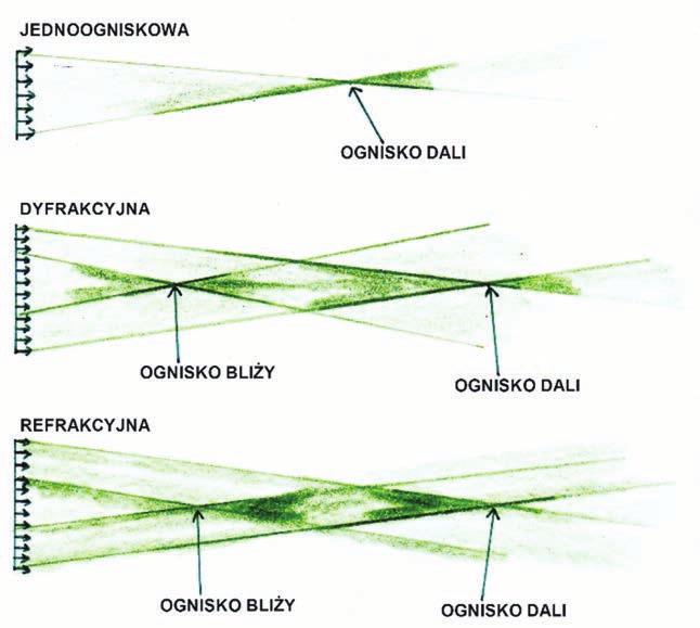 RYCINA 1 Rozdział światła w soczewkach jedno- i wieloogniskowych dyfrakcyjnych oraz refrakcyjnych (materiał własny Autora).