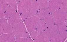 Naked VEGF gene transfer increases the number of microvessels in the ischemic rabbit