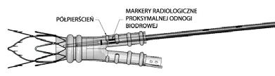 Wprowadzenie i umieszczenie odnogi kontralateralnej 1 Etapy przygotowania systemu opisuje część Przygotowanie systemu/systemów wprowadzania.