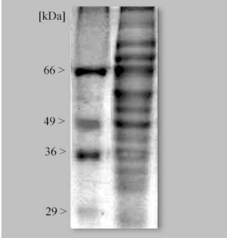 110 G. Zaleœny i wsp. i Syphacia obvelata należące do rodziny Oxyuridae [1].