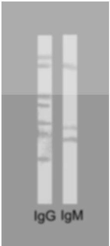 Antygeny somatyczne A. teteraptera 111 wała przy użyciu konkawaliny A według metody Schallinga [12] z modyfikacjami.