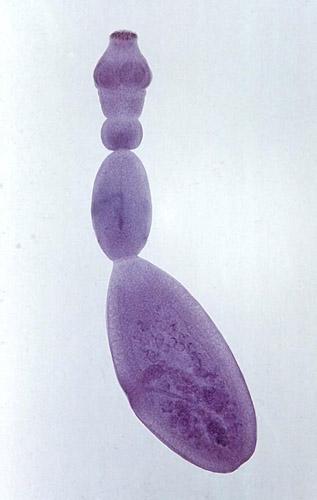 Echinococcus granulosus - tasiemiec bąblowcowy