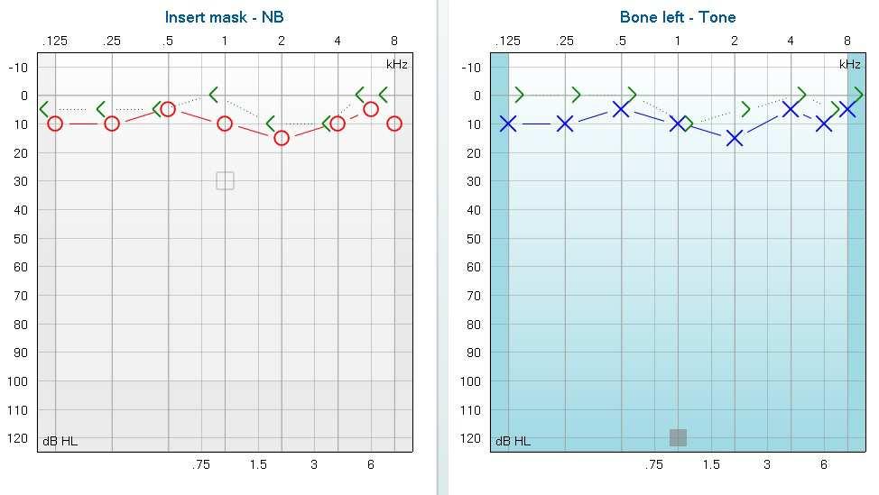 SYMBOLE Ucho lewe: Krzywa powietrzna niebieskie X Krzywa kostna niebieskie > AUDIOGRAM W NORMIE