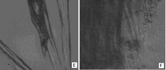 Microcopy picture of biofilm formation by B. subtilis B3 in different culture media.