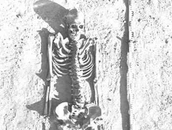 28 Homines Hominibus nr 1(4) 2008 nieco ostrożniej patrzeć na to, że dolegliwości szkieletu osiowego są efektem przemian cywilizacyjnych.