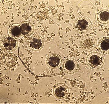 blastocysty