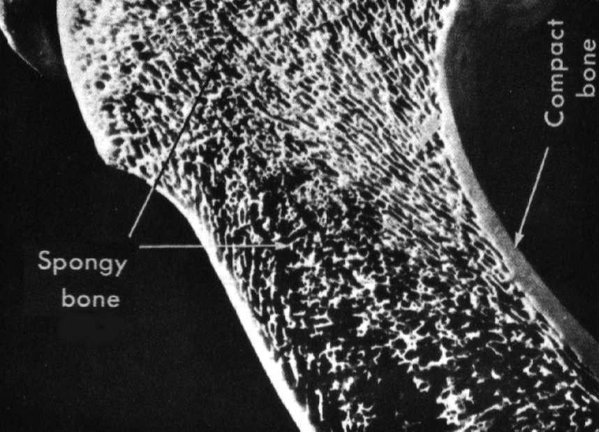 wewnątrzkomórkowe w lizosomach aktywny osteoklast nieaktywny osteoklast osteoblasty komórki zrębowe szpiku