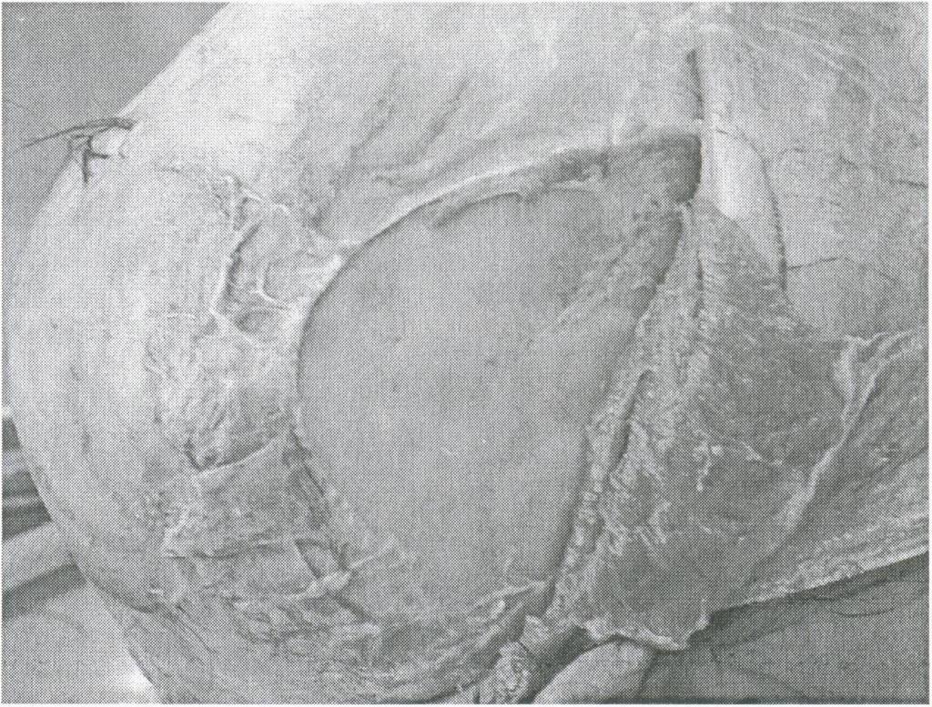 Ryc. 3. Brak uszkodzeń czaszki po strzale z przyłożenia z dowodowego pistoletu. Fig. 3. Lack of skull injuries after a contact discharge from the evidential gun.