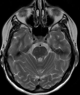 Udar mostu diagnostyka