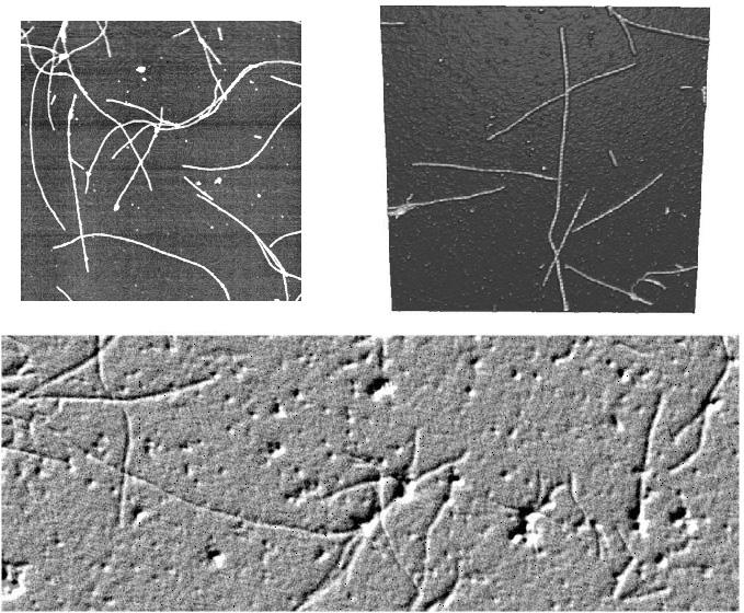 TERAPEUTYCZNE DZIA ANIE PEPTYDÓW STOSOWANYCH 15 Rysunek 7. Figure 7. Zdjêcia z mikroskopu elektronowego samoorganizuj¹cych siê struktur peptydowych w³ókna β-amyloidu. Obraz ma 5 5 μm.