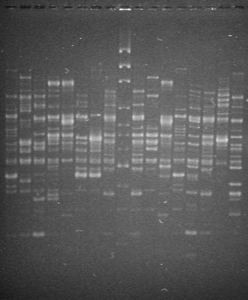 Nr 3 Typowanie P. aeruginosa metodą PCR-RAPD 215 W wyniku rozdziału produktu amplifikacji DNA 16 szczepów uzyskano 14 różnych wzorów prążków z wykorzystaniem startera 208 (Ryc. 4).