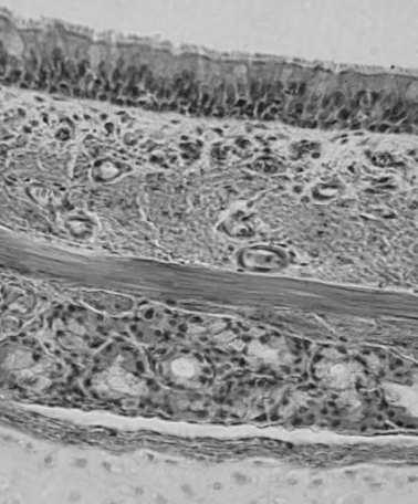 antybakteryjnych (lizozymu, laktoferyny) produkowanych przez komórki gruczołów łzowych Komórki wydzielające