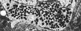 komórki główne (przytarczyce) komórki A, B, D, PP (wysepki trzustkowe) komórki chromochłonne (rdzeń nadnerczy) komórki chemoreceptoryczne kłębków szyjnych i