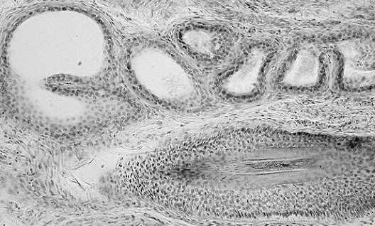 ceramidy, glikolipidy, estry cholesterolu