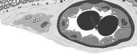 doczesnowe (matki) limfocyty T i NK (matki) makrofagi (matki) cytotrofoblast obwodowy (płodu)