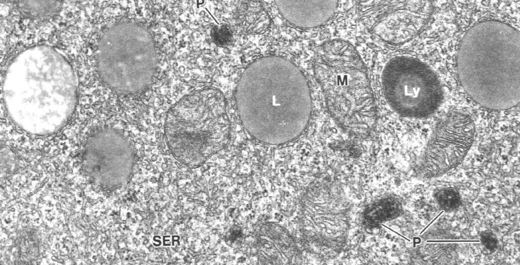 Golgi liczne ziarna wydzielnicze równomiernie rozmieszczone w cytoplazmie Komórki produkujące aminy biogenne