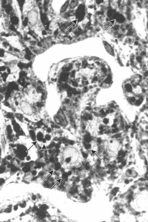 PODWZGÓRZE akson kula Herringa Dwa szlaki podwzgórze-przysadka: małe komórki neurosekretoryczne (jąder drobnokomórkowych) duże komórki produkują czynniki (hormony) neurosekretoryczne regulujące