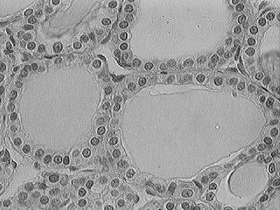 hydrolazowe endocytoza trawienie jodowanej tyreoglobuliny w lizosomach synteza tyreoglobuliny i tyreoperoksydazy aminokwasy anion jodkowy Etapy produkcji hormonów tarczycowych T3 i T4: TSH związany z