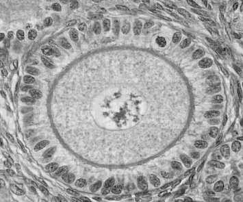 blaszki pierścieniowate (fragmenty otoczki jądrowej w porami w cytoplazmie) liczne cząsteczki mrna Oocyt: