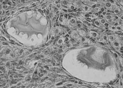 Atrezja: apoptoza oocytu i komórek pęcherzykowych usunięcie szczątków przez makrofagi może
