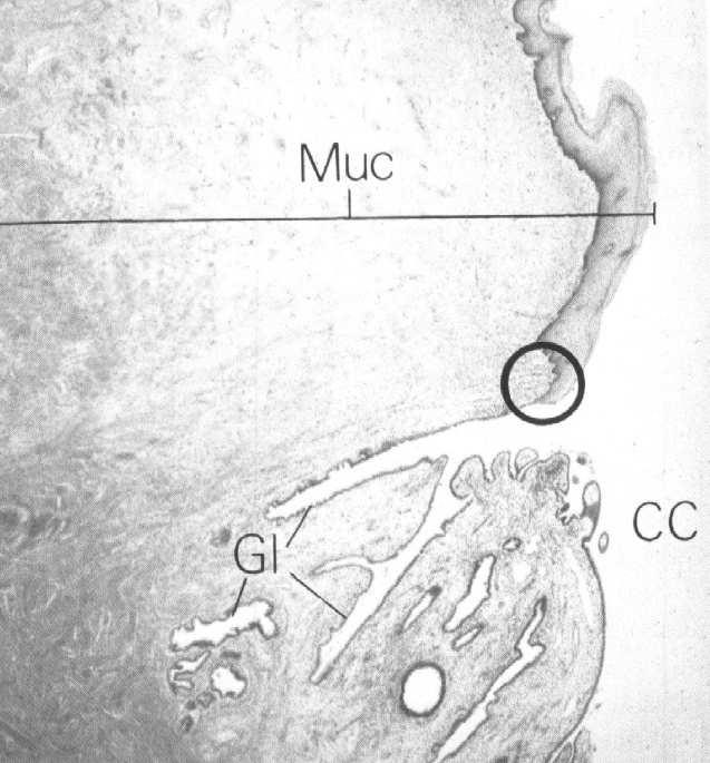 wydzielnicza Szyjka macicy nabłonek: komórki wydzielnicze (śluzowe) i komórki z