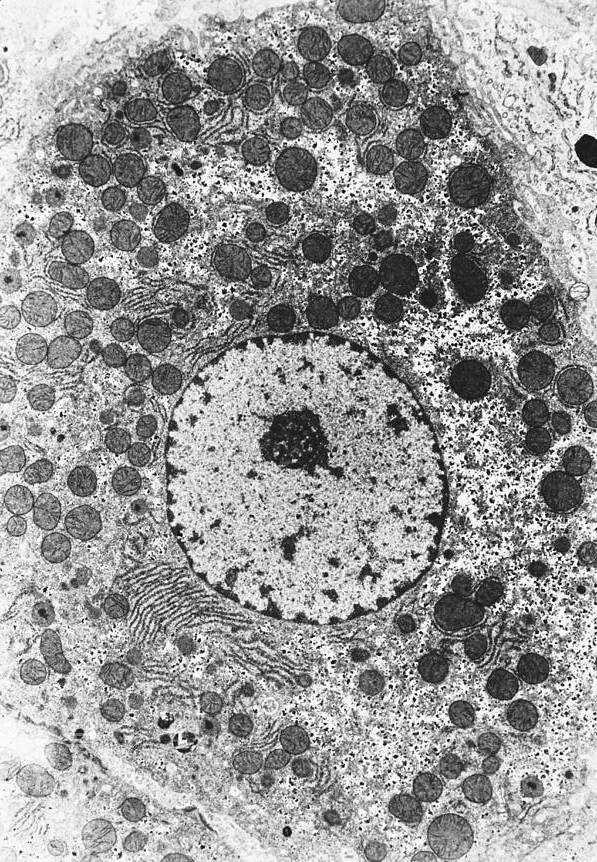 Strefy gronka wątrobowego: 1 bogata w tlen (aktywnego metabolizmu) 2 pośrednia (zmiennego metabolizmu) 3