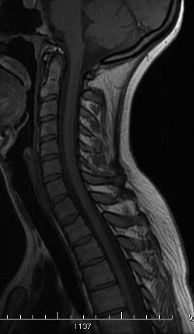 Anatomia MR kręgosłupa łuk przedni C1 worek oponowy łuk tylny C1 krążek m-kr.
