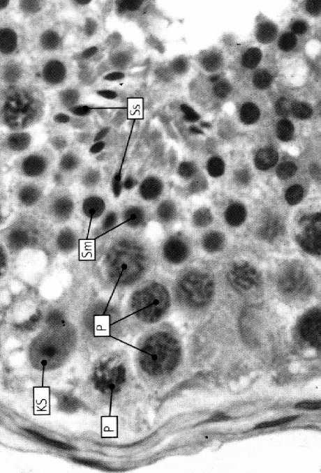 spermatogonie B: ciemne skupiska chromatyny, duże jąderko spermatocyty I