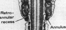 akrosom witka: - szyjka: centriole otoczone część przez 9 kolumn końcowa białkowych - część