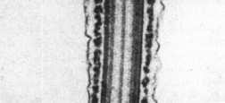 , mankiet mitochondrialny - część główna: aksonema, 7 gęstych włókien zewn.