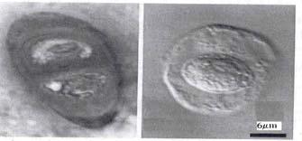K. Wierzcholski, A. Miszczak.Wstpne informacje Rysunek pokazuje chondrocyt o wymiarach [m] [m] w chondrionie znajdujcym si w chrzstce stawowej czowieka. a) b) c) Rys.