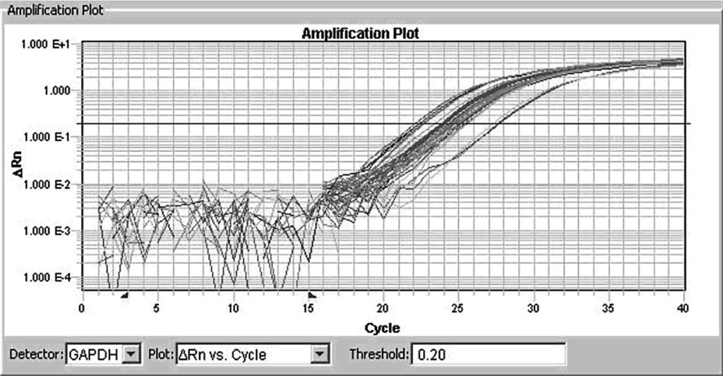 genu LGALS3BP w raku brodawkowatym tarczycy (RBT) Krzysztof Kaliszewski i wsp. Rycina 3. Reakcja łańcuchowa polimerazy (PCR) w czasie rzeczywistym dla genu GAPDH Figure 3.