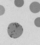 układu czerwonokrwinkowego: 1. całkowita zawartość erytrocytów /mm 3 2. wskaźnik hematokrytu 3.