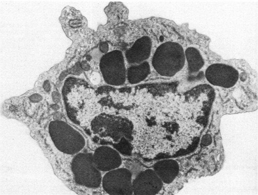 ECP (białko kationowe eozynofili) - EDN (eozynofilową neurotoksynę) - eozynofilową peroksydazę - enzymy hydrolityczne