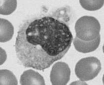 µm nerkowate jądro dobrze rozwinięte organelle ziarna azurochłonne zdolność do