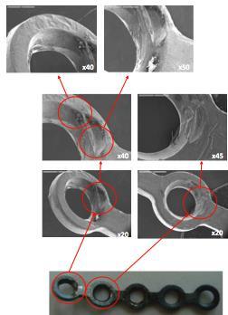 The miniplates also showed damage resulting from the interaction between the plate and the fixing screws. Fig. 8. Image of plate fractured surfaces; damage to surface having contact with patient Fig.