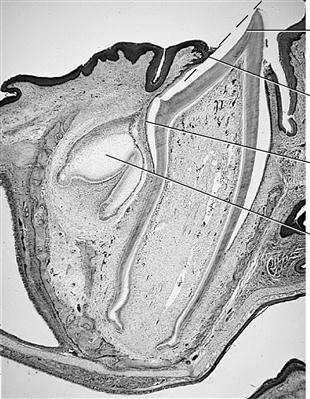 powierzchni błony śluzowej nabłonek narządu szkliwotwórczego pokrywający koronę ulega fuzji z nabłonkiem jamy