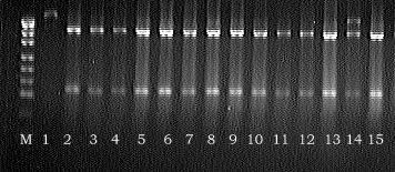53 Rycina 4. Rozdział fragmentów DNA w 3% żelu agarozowym po trawieniu amplifikowanego fragmentu genu PRNP zawierającego kodon 151 restryktazą AvaII.