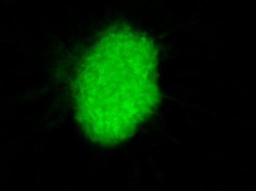 cells) β-iii tubulin