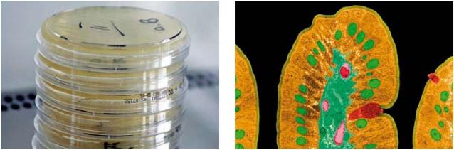 Staphylococcus aureus paciorkowice beta-hemolizujące Klebsiella spp. Flora bakteryjna kału beztlenowa Bacteroides spp. Clostridium spp. Bifidobacterium spp.