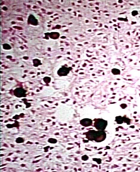 Cytoplazma z licznymi wypustkami SER, rybosomy, AG, mikrotubule.