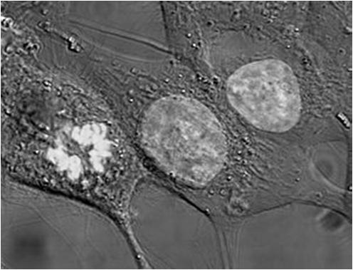 Komórka eukariotyczna http://pl.wikipedia.org/w/index.php?title=plik:hela_cells_stained_with_hoechst_33258.