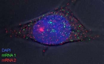 Single molecule FISH to metoda in situ hybrydyzacji pozwalająca na obrazowanie pojedynczej cząsteczki mrna w komórce dzięki wykorzystaniu wielu fluorescencyjnie wyznakowanych sond zaprojektowanych do