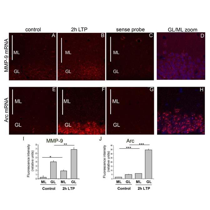 In situ hybridization shows increse in MMP-9 expression in granular