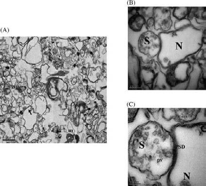 Synaptoneurosomy w