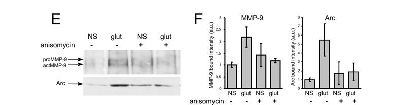 Dziembowska et al., J Neurosci.