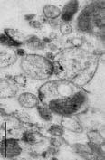 Coimmunoprecipitation of FMRP protein with MMP-9 mrna Synaptoneurosome extract anti-fmrp antibody or normal IgG