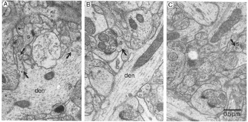 Polyribosomes localized in