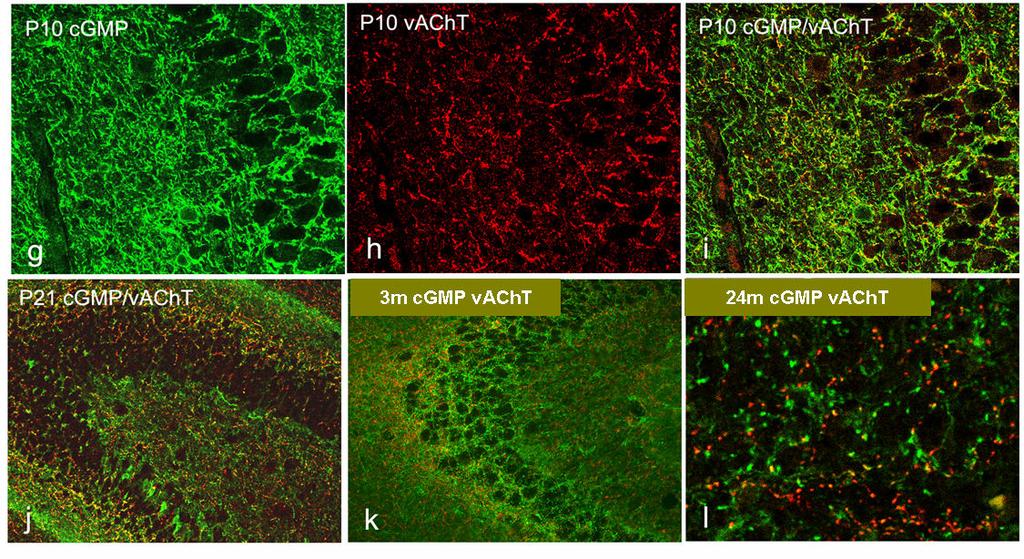 cgmp i vacht występowała bardzo rzadko (Rycina 17.). Rycina 17. Lokalizacja cgmp (zielony) we włóknach cholinergicznych hipokampa metodą immunohistochemiczną przykładowe fotografie.